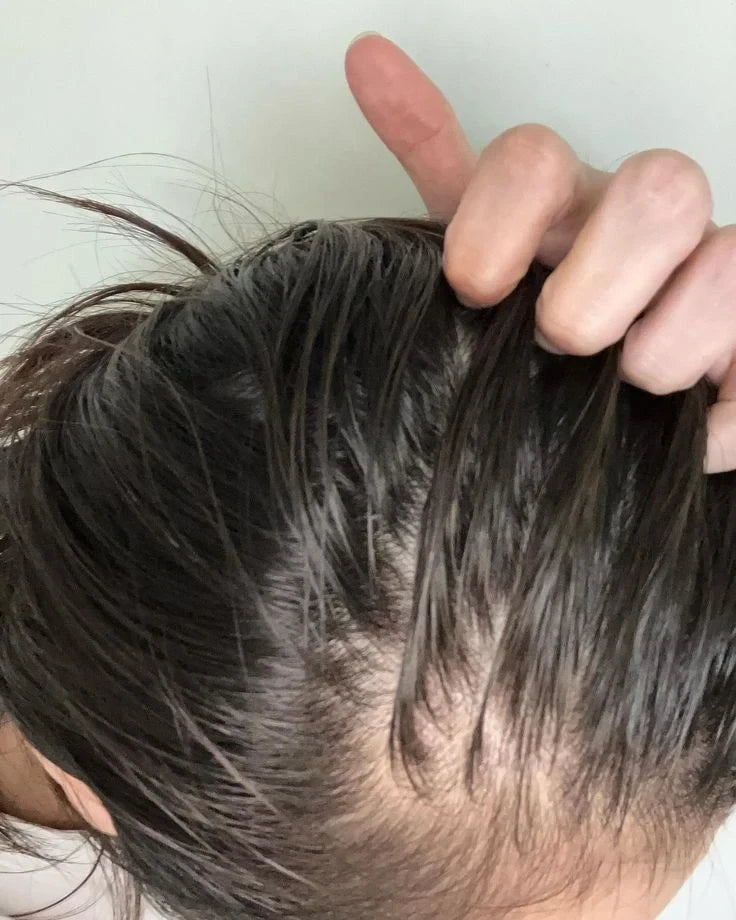 Aromatica Rosemary Root Enhancer & Scalp Scaling Shampoo - For Scalp Health & Hair Growth