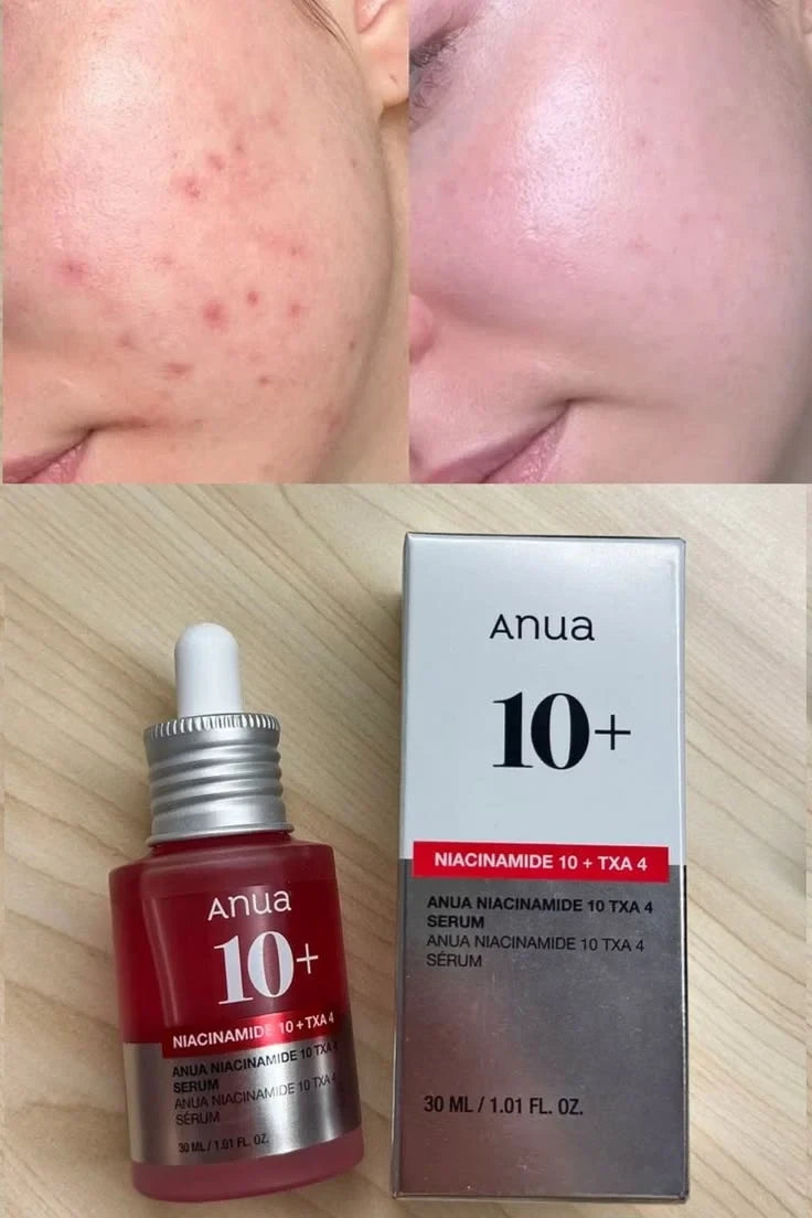 Anua Niacinamide 10% + TXA 4% Serum - Dark Spot Correcting & Brightening Serum