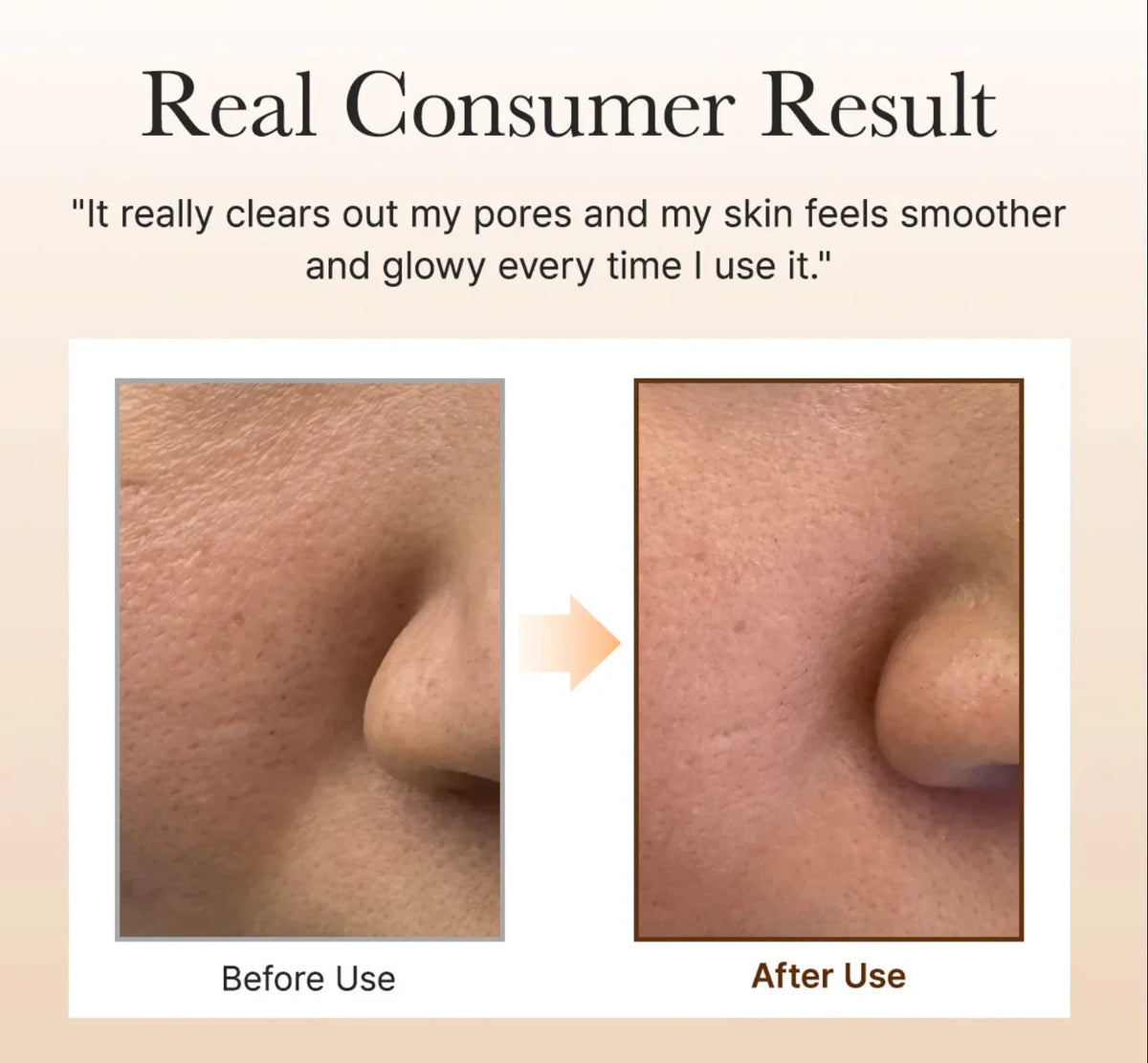 Arencia Fresh Green Rice Mochi Cleanser (120g) - Deep Pore Purifying & Anti-Acne