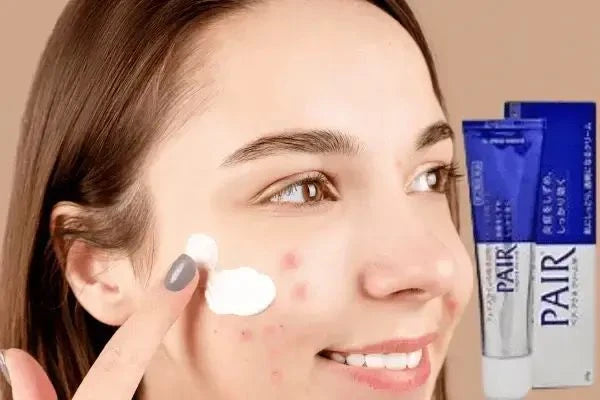 Lion Pair Acne Cream W - Highly Effective Acne & Pimples Treatment Cream