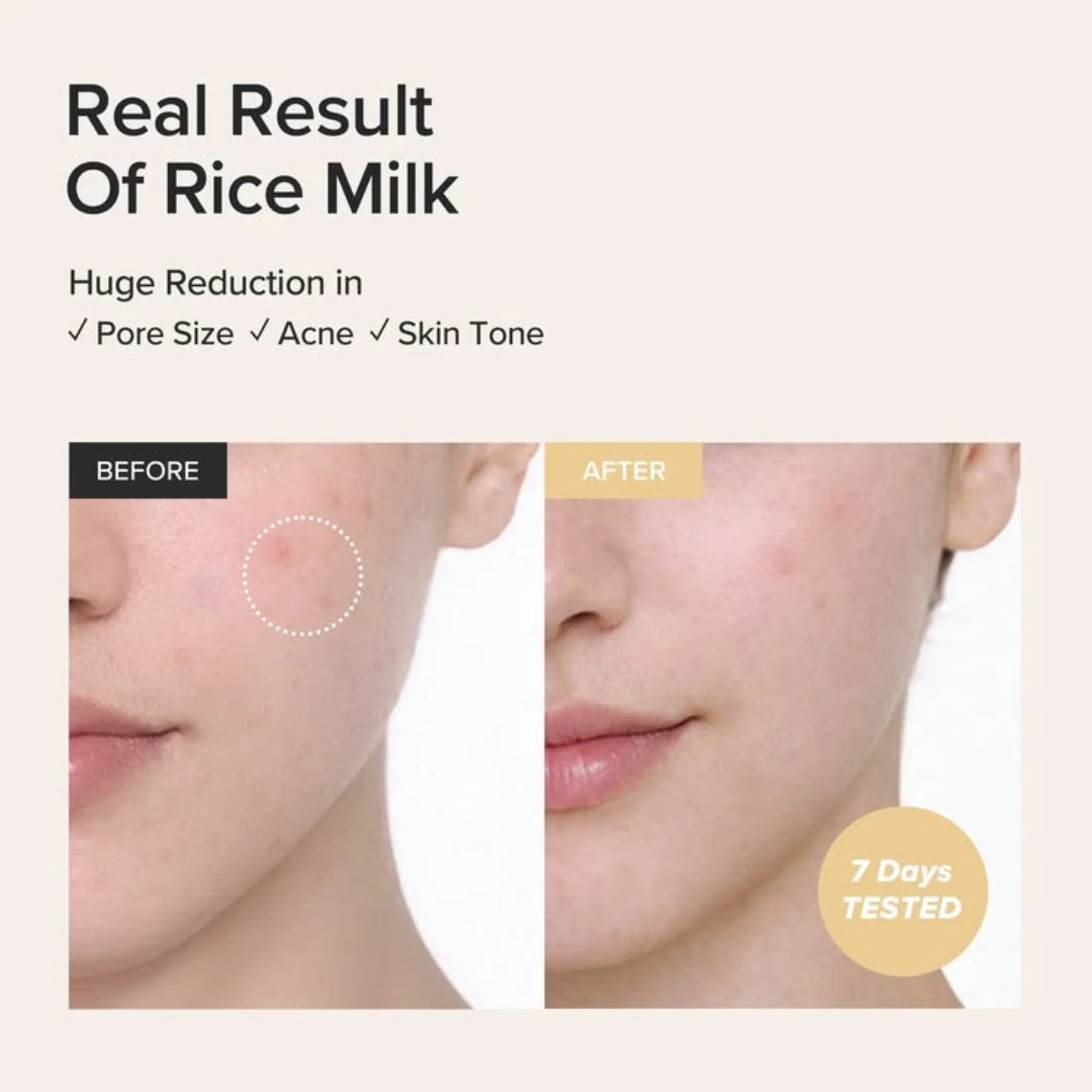 Beauty of Joseon Glow Replenishing Rice Milk 150ml - Deeply Hydrating, Nourishing & Skin Barrier Repairing Rice Toner