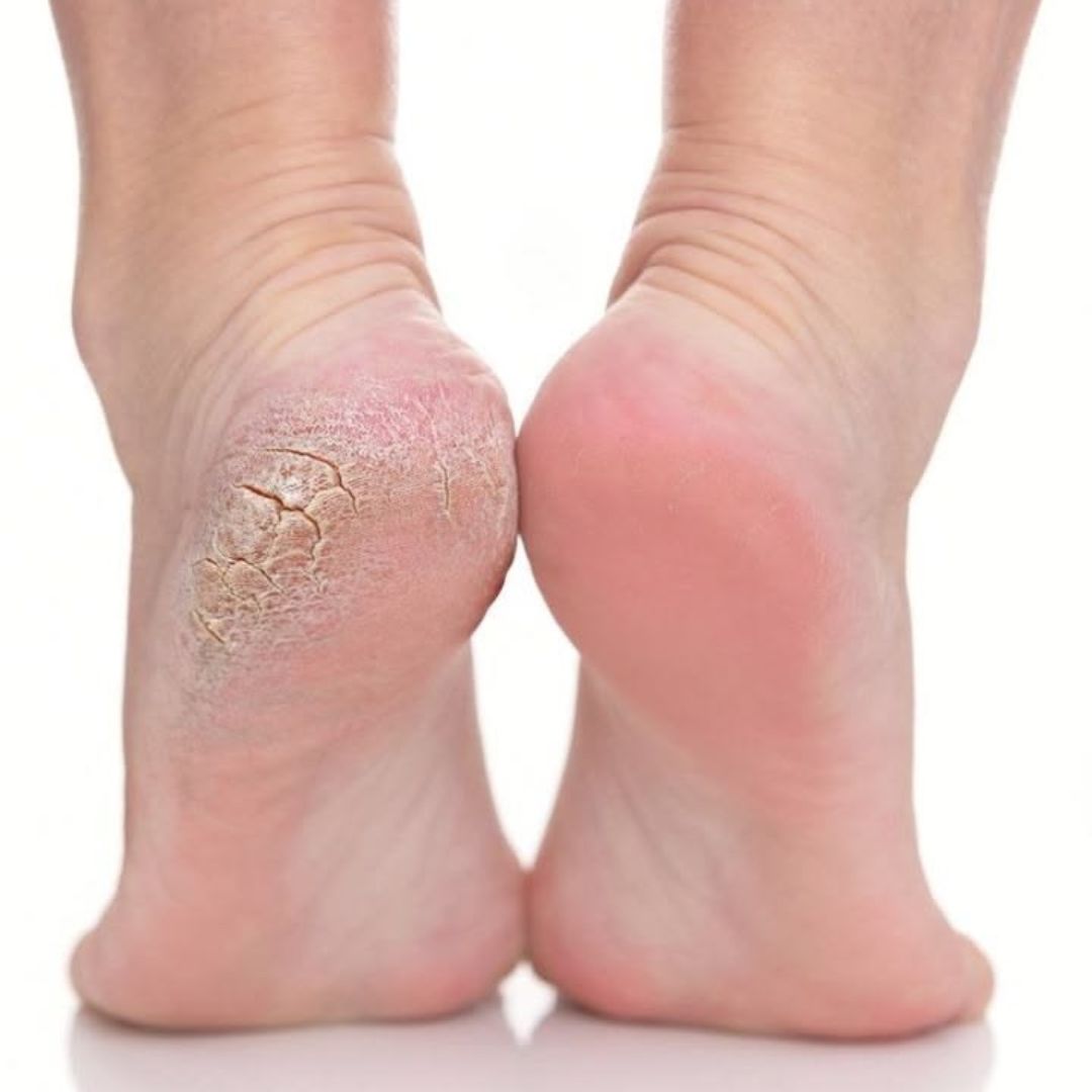 The Saem Pure Natural Foot Treatment Mask (1 Pair) - Intensive Hydrating & Softening Foot Mask