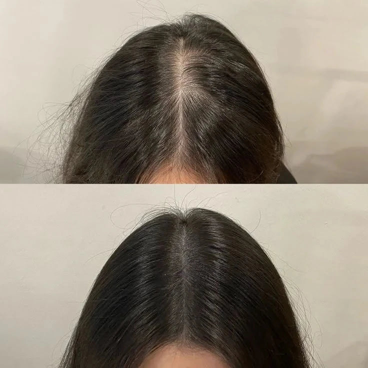 VT Cosmetics PDRN Reedle Shot Hair Ampoule (15ml) - Anti-Hair Fall & Hair Growth